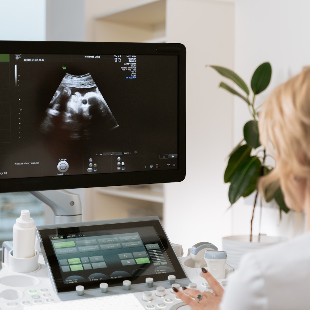 Doctor with ultrasound image on a monitor