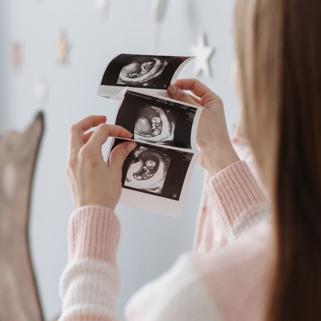 A Woman Holding an Ultrasound Image