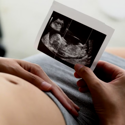 Ultrasound-Based Nub Theory Gender Prediction during Pregnancy